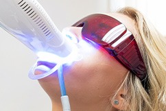Patient undergoing in-practice teeth whitening