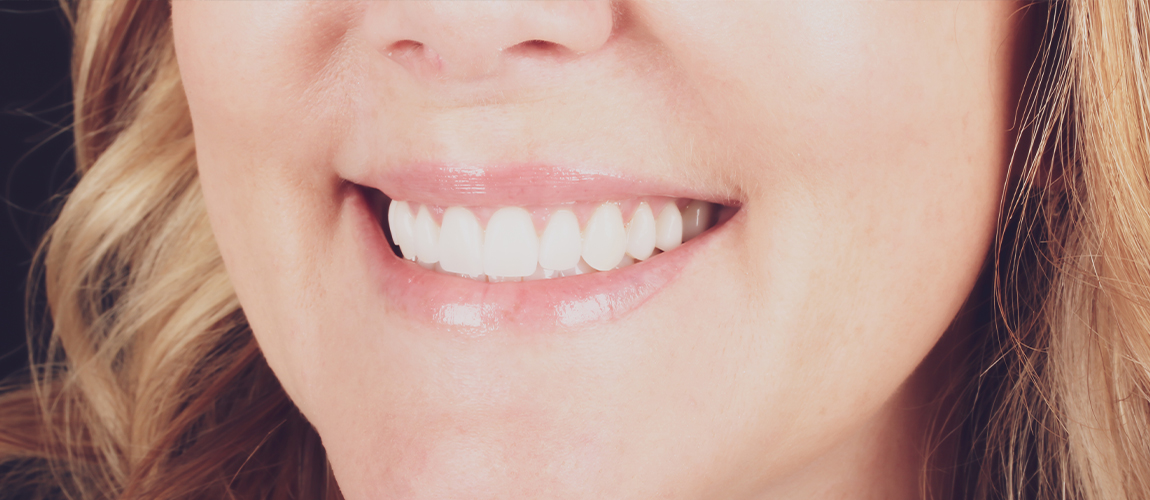 Close up of Slidell dental patient smiling