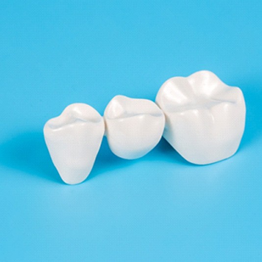 A dental bridge laying against a blue background