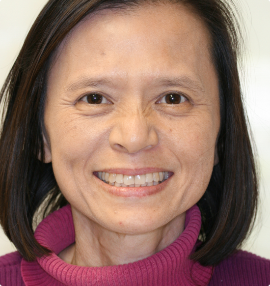 Woman with a bob haircut smiling