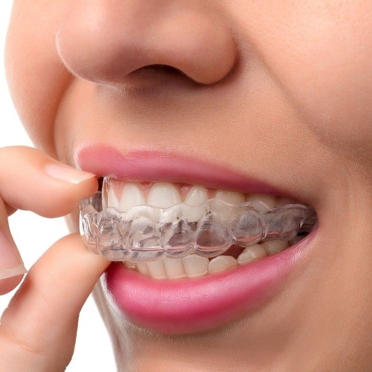 Close up of person putting clear aligner in their mouth