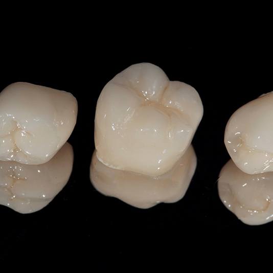 Three dental crowns on a black background