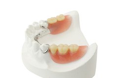 Partial dentures on a model of teeth