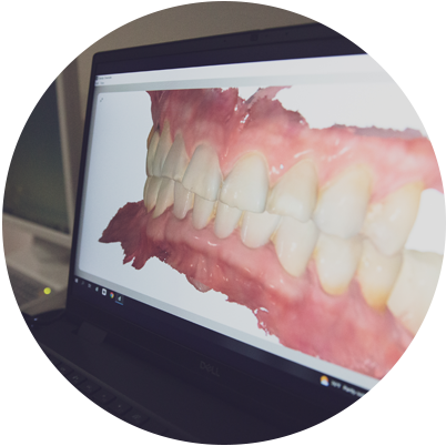 Close up of photo of dental patient's teeth on computer screen