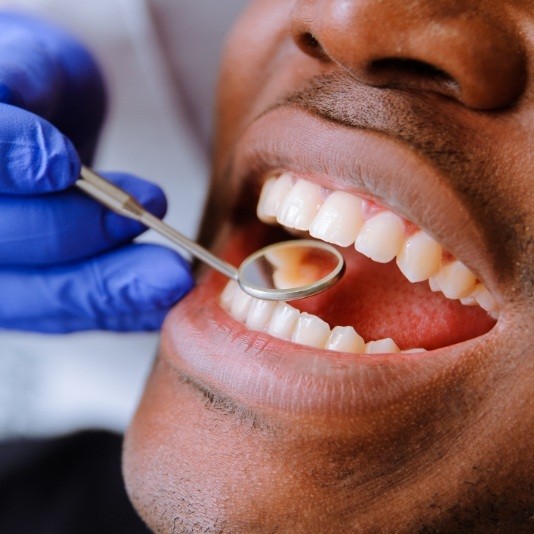 Dental patient with dental mirror in his mouth