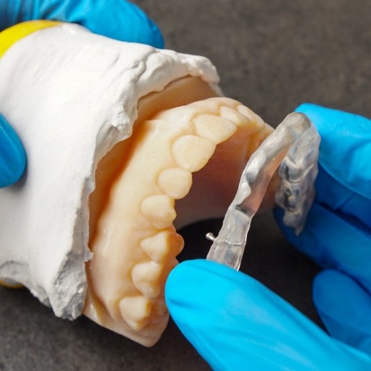 Dentist placing a splint on a model of the teeth