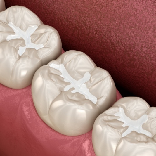 Animated row of teeth with dental sealants