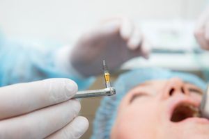 Closeup of dental implant about to be put into patient's mouth